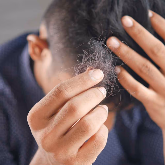 National Hair Loss Awareness Month