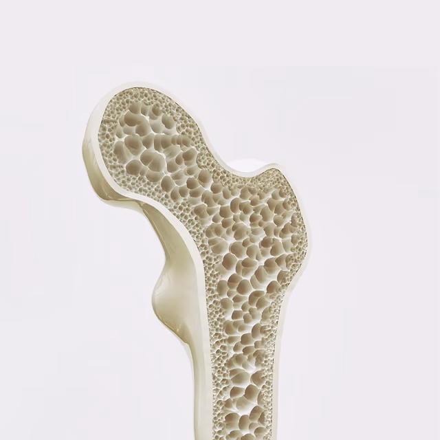 National Osteoporosis Month