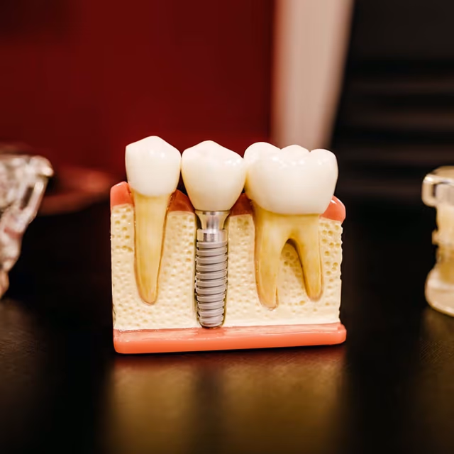 Root Canal Appreciation Day