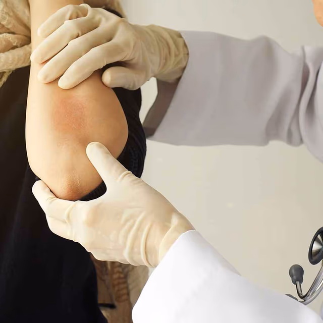 World Psoriasis Day