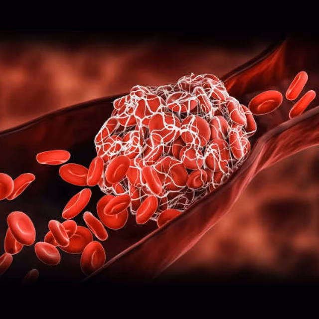 World Thrombosis Day